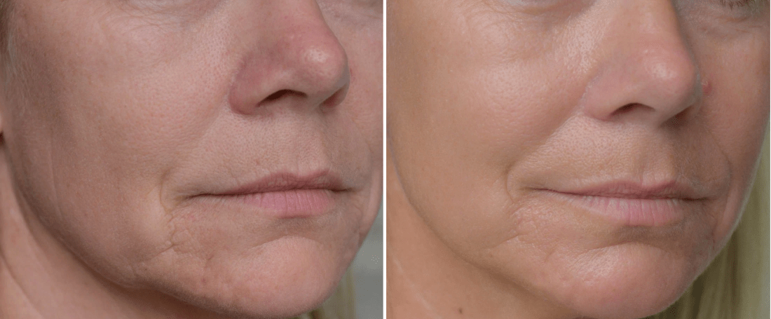 Skärmavbild 2019-08-31 kl. 14.07.57